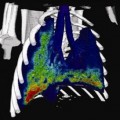 4D dynamic functional lung imaging method