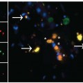 ALS macrophages