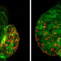 Ajuba regulates stem cell activity in the heart