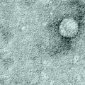 An image of hepatitis C