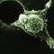An invasive cancer cell moves with its leading edge