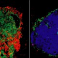 Antibodies reverse Type 1 diabetes