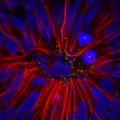 Brain cells created from patients’ skin cells