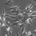 Cardiomyocytes-human