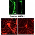Expression of a single gene dramatically decreases synaptic connections between brain cells
