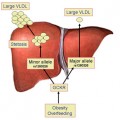 Fatty liver in obesity