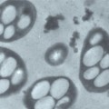 GFAJ-1-arsenic-tolerant-bacterium-microscope
