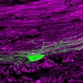 Gene Therapy to Boost Brain Repair