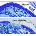 Genes promote cartilage healing and protect against arthritis