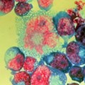 HIV-infected T-cells