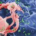 HIV virus