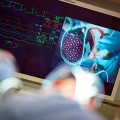 Heart attack worsens atherosclerosis
