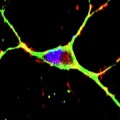 Huntington's disease mouse model