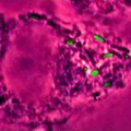 Internal cellular sensors make Salmonella dangerous