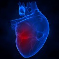 Key factors linked to lower death rates among patients with heart attacks