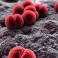 Meningitis-Outbreak