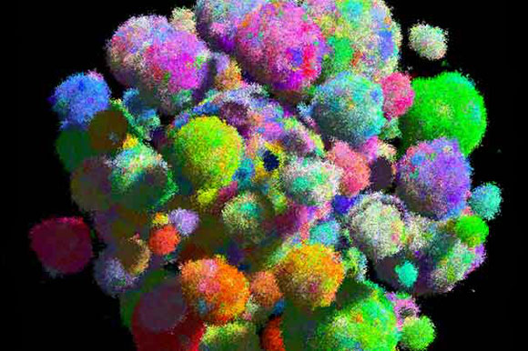 New Model Captures Shape and Speed of Tumor Growth for the First Time