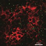 Nanoparticles in food could harm human health