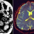 New algorithm can analyze information from medical images