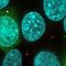 NoBody, A Microprotein on a Mission
