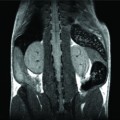Non-invasive visualization of a mouse by Magnetic Resonance Imaging