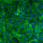 PRKCA-HR-kinase-protein