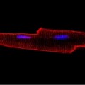 Popdc proteins stained red
