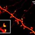 STED image of a nerve cell in the upper brain