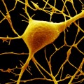 Sahin Autism Purkinje cell
