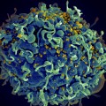 Scanning electron micrograph of HIV particles