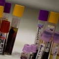 Some HDL may not protect against heart disease