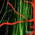 Spinal Cord Imagery