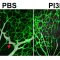 Study Reveals a Possible Treatment for a Rare Vascular Disease