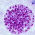 Toxoplasma-gondii