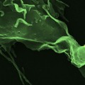 Tuberculosis vaccine being tested