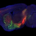 Using rabies virus, researchers are able to track neural pathways