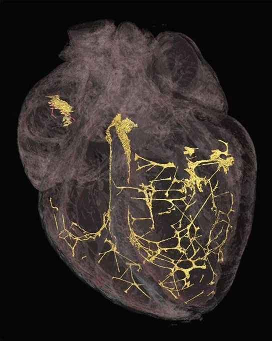 X-ray technique to identify tissue fibers in the heart