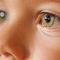 Zika and Glaucoma Linked for First Time