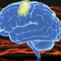 after a stroke, these muscle synergies are activated in altered ways