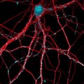antibodies halt Alzheimer’s disease in mice