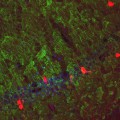 anxiety-reducing effect of intranasally administered neuropeptide S