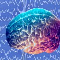 brain-during-epileptic-seizure