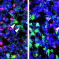 cancer-stem-cell-parada-chen
