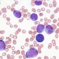 cd47-cancer-antibody-drug