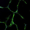 cells derived from amniotic fluid forming capillary-like networks