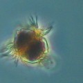 ciliate-mesodinium-protozoan