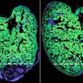 damaged-heart-muscle-repair
