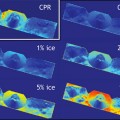 data indicate that the walls of Shackleton crater may hold ice