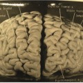 einstein-frontal-brain