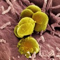 electron-micrograph-Neisseria-gonorrhoeae